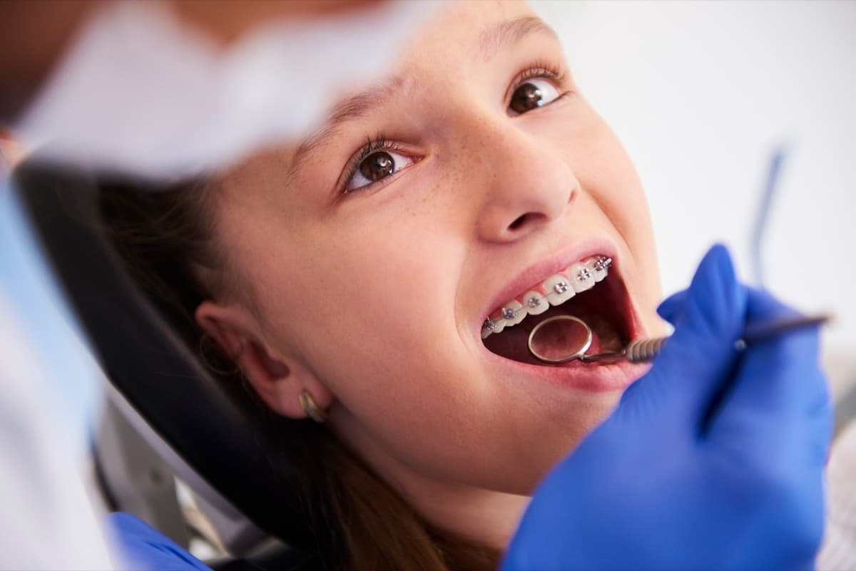 Criança sorrindo durante atendimento odontopediátrico com aparelho ortodôntico